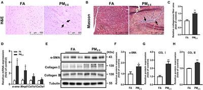 TGF-β-Containing Small Extracellular Vesicles From PM2.5-Activated Macrophages Induces Cardiotoxicity